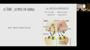 Les troubles du neurodeveloppement